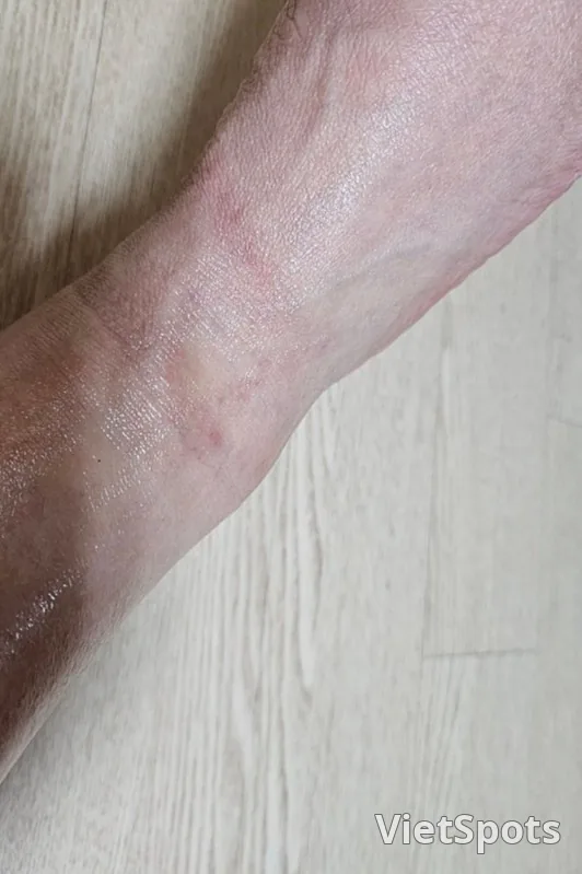 🇻🇳(Đánh giá) Ý định mua lại 100%_Đánh giá sau khi sử dụng SHALONPAS GEL