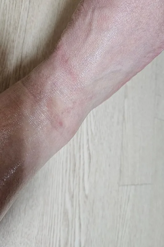 🇻🇳(Đánh giá) Ý định mua lại 100%_Đánh giá sau khi sử dụng SHALONPAS GEL